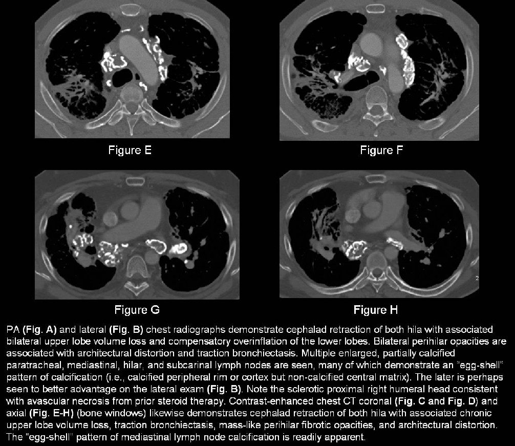 Radiograph 5 from archived case 21