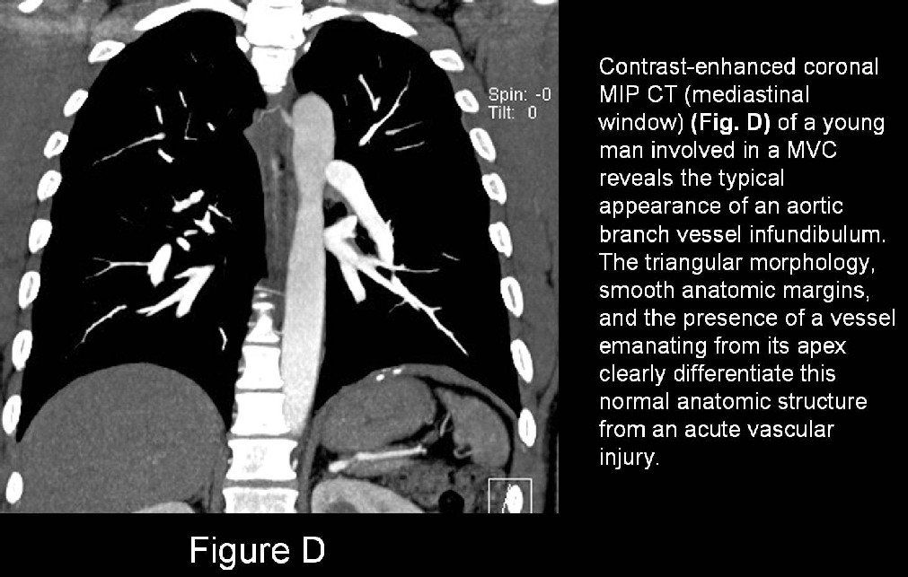 Radiograph 5 from archived case 17