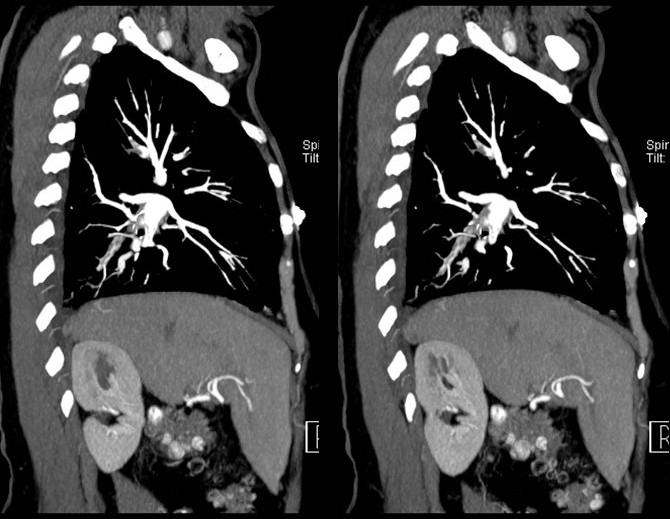 Radiograph 4 from archived case 3