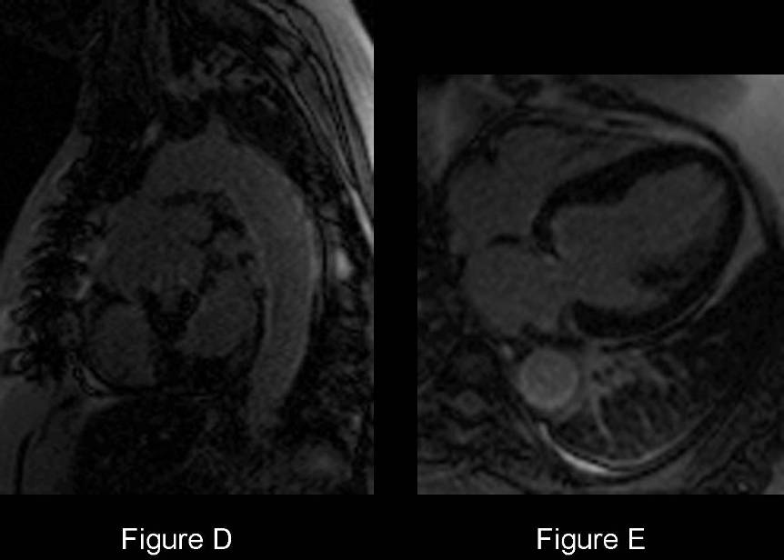 Radiograph 5 from archived case 51