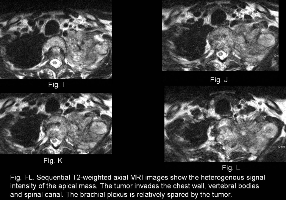 Radiograph 5 from archived case 28