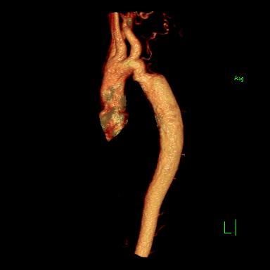 Radiograph 5 from archived case 72