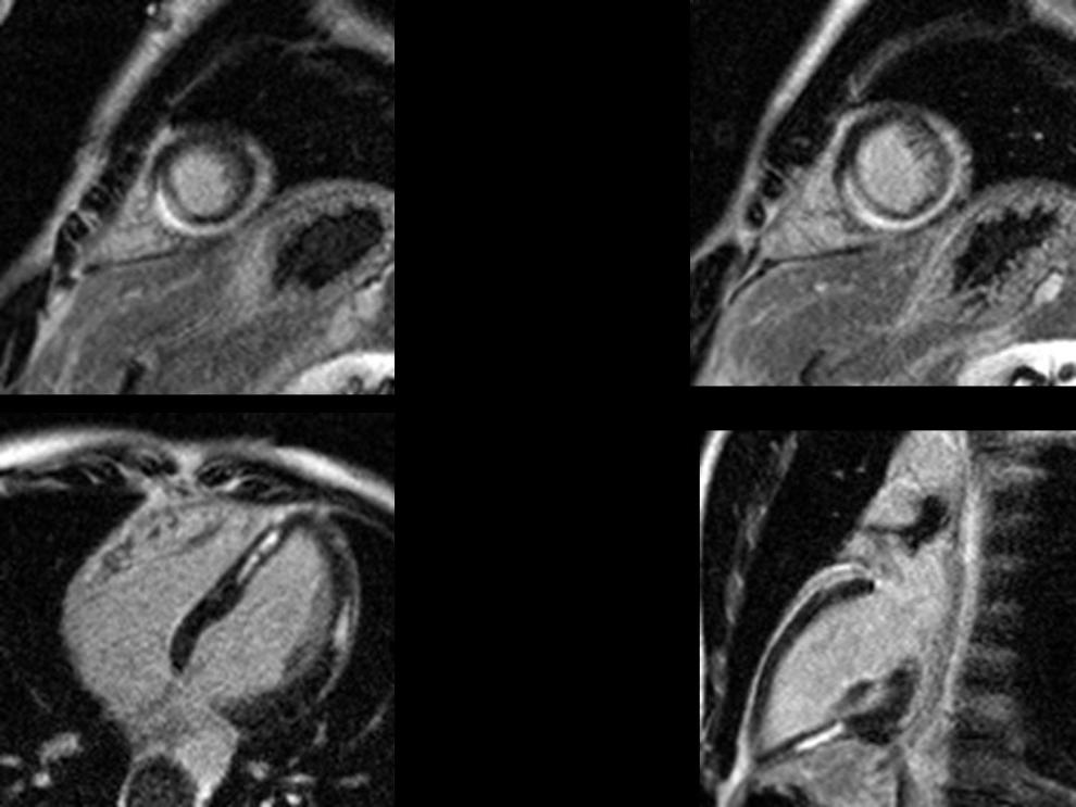 Radiograph 5 from archived case 73