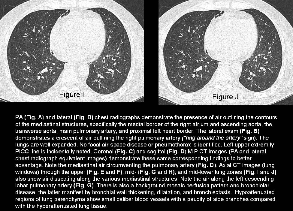 Radiograph 7 from archived case 37