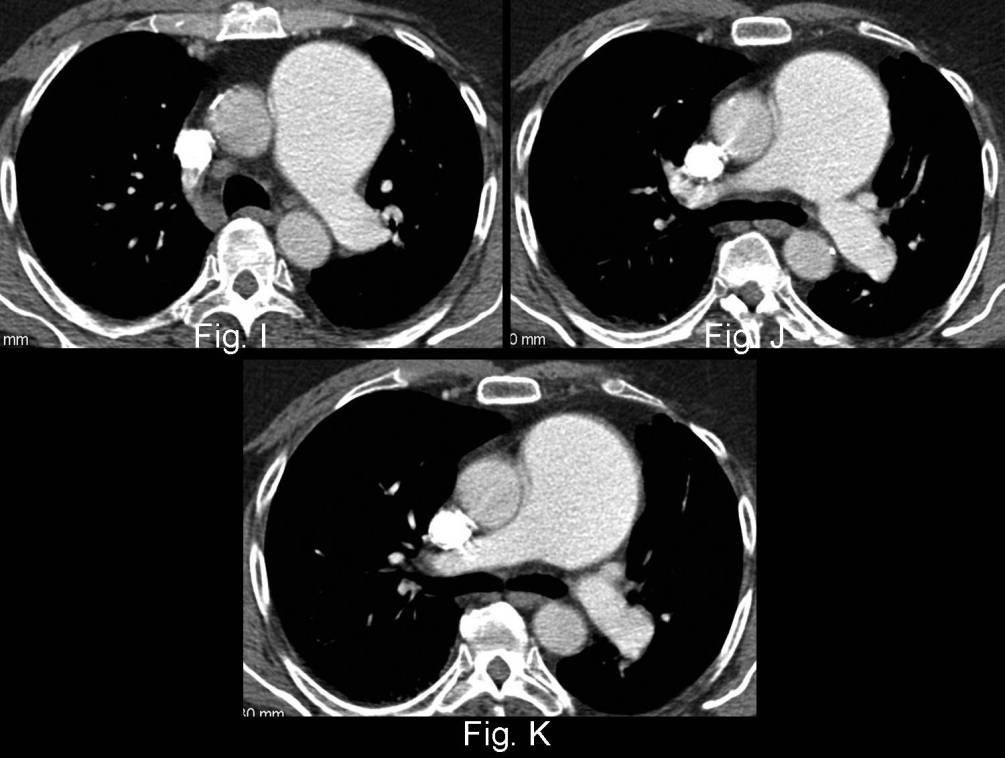 Radiograph 7 from archived case 46
