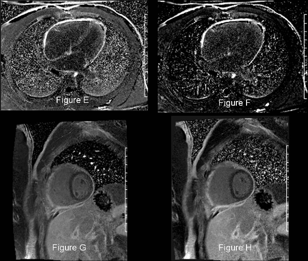 Radiograph 5 from archived case 38