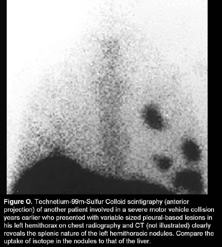 Radiograph 6 from archived case 15
