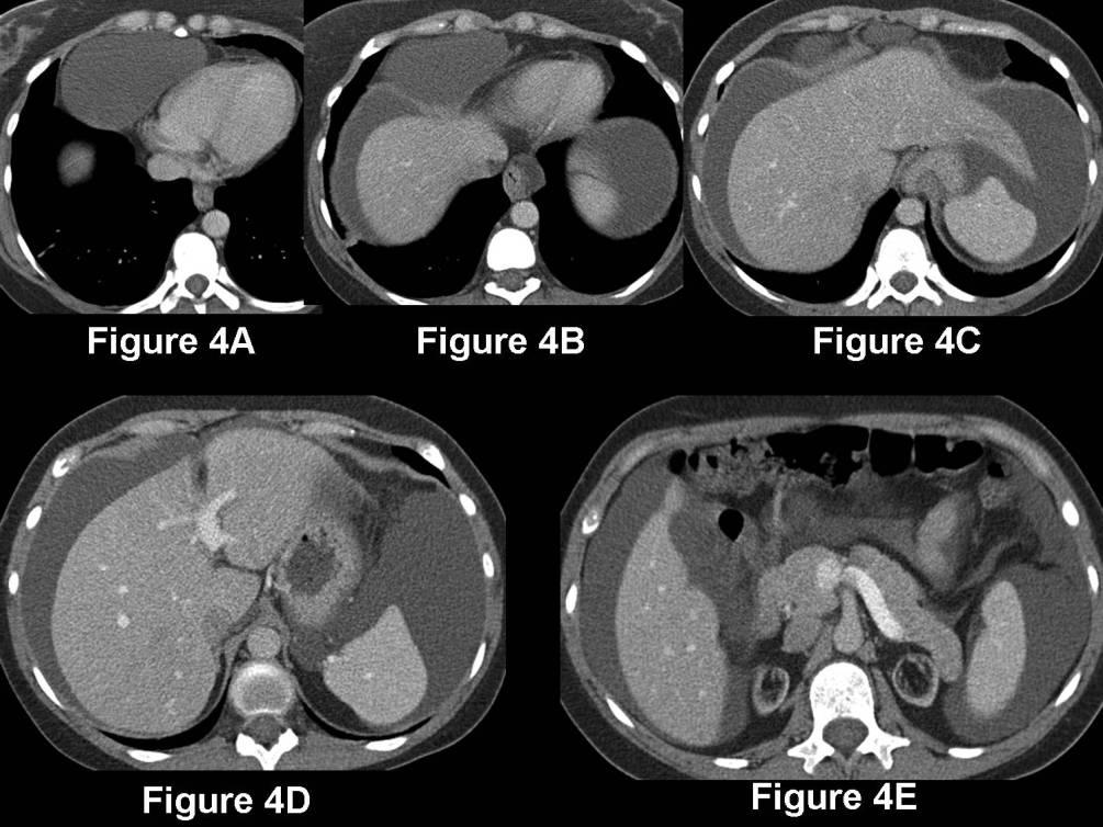 Radiograph 7 from archived case 67