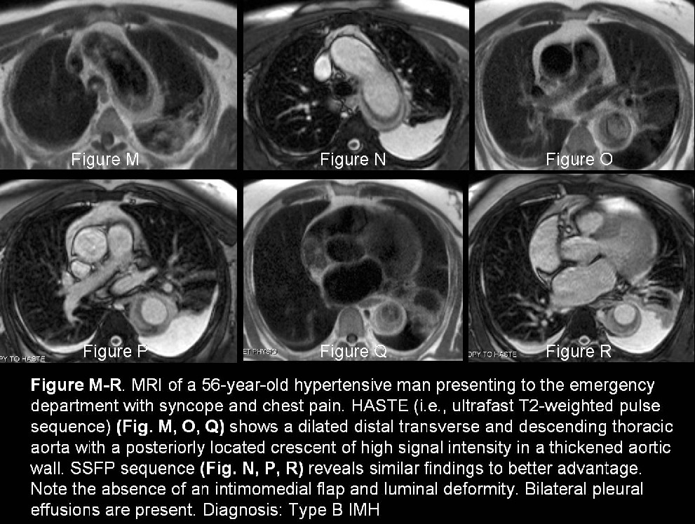 Radiograph 6 from archived case 25