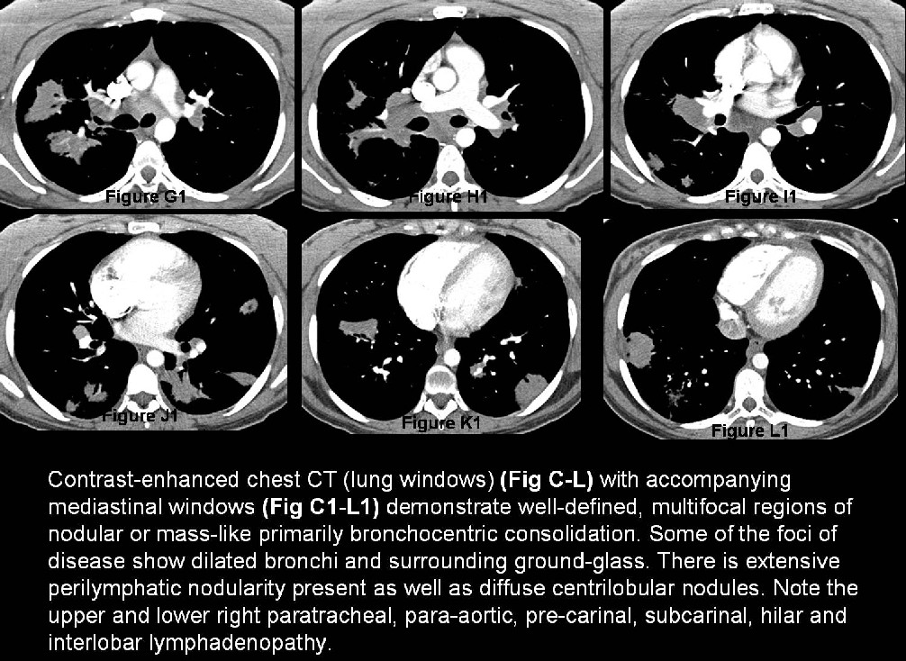 Radiograph 7 from archived case 23
