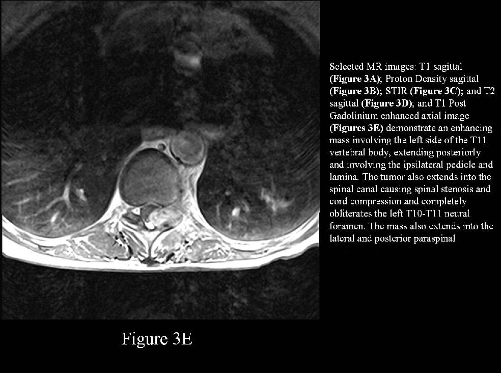 Radiograph 7 from archived case 11