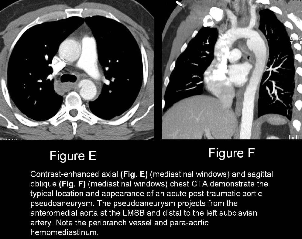 Radiograph 6 from archived case 17