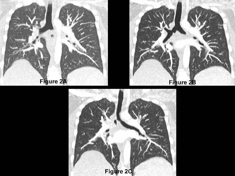 Radiograph 2 from archived case 79