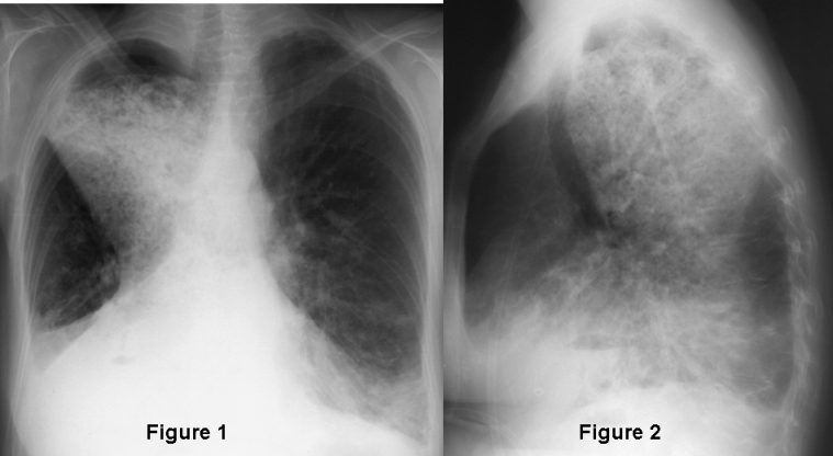 Radiograph 1 from archived case 43