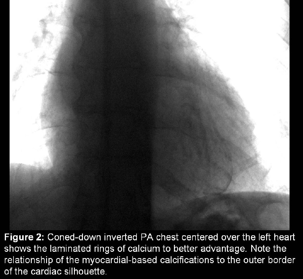 Radiograph 3 from archived case 10