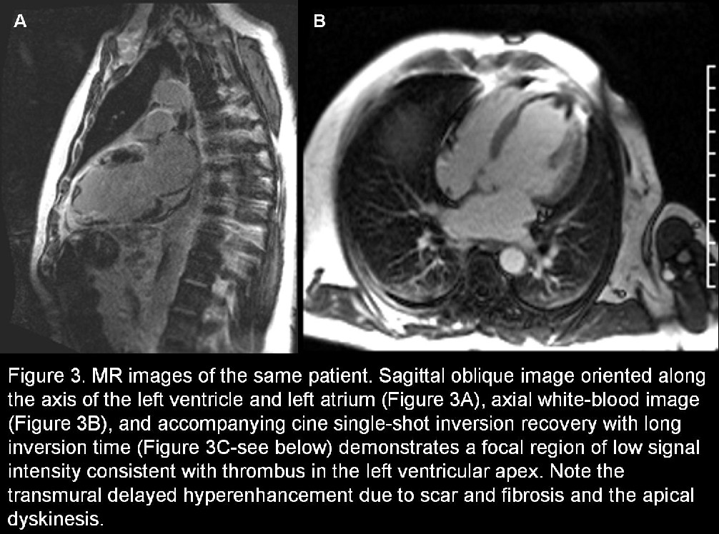 Radiograph 4 from archived case 10