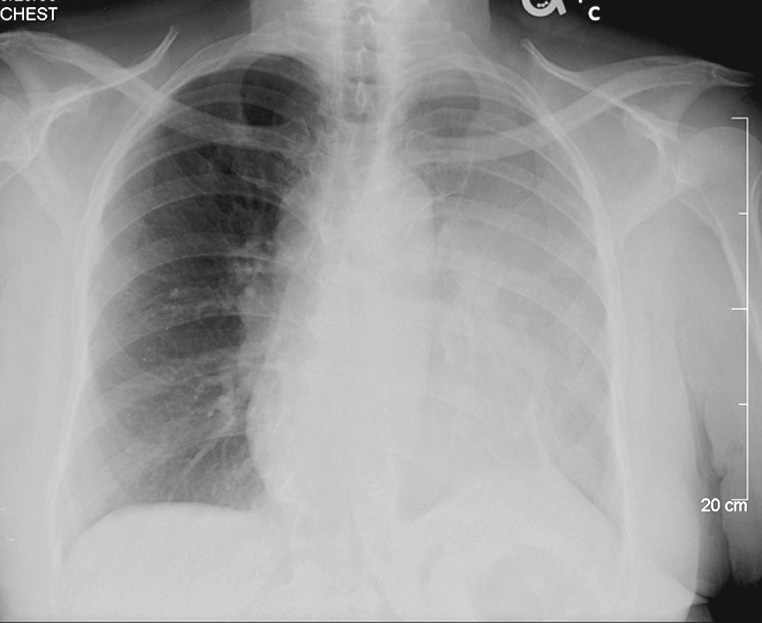 Radiograph 1 from archived case 2