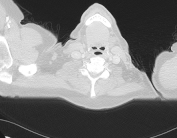 Radiograph 4 from archived case 228