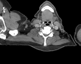 Radiograph 3 from archived case 228