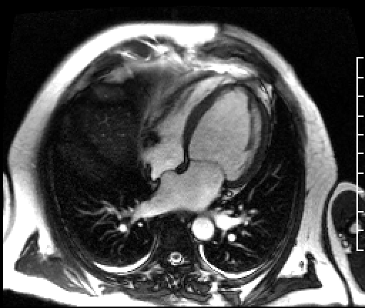 Radiograph 5 from archived case 10